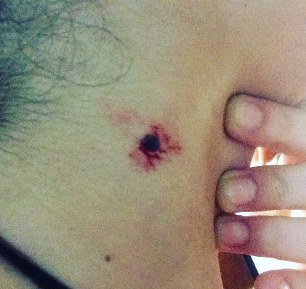 İstanbul metroda kadın müzisyene polislerden darp iddiası - Resim: 4