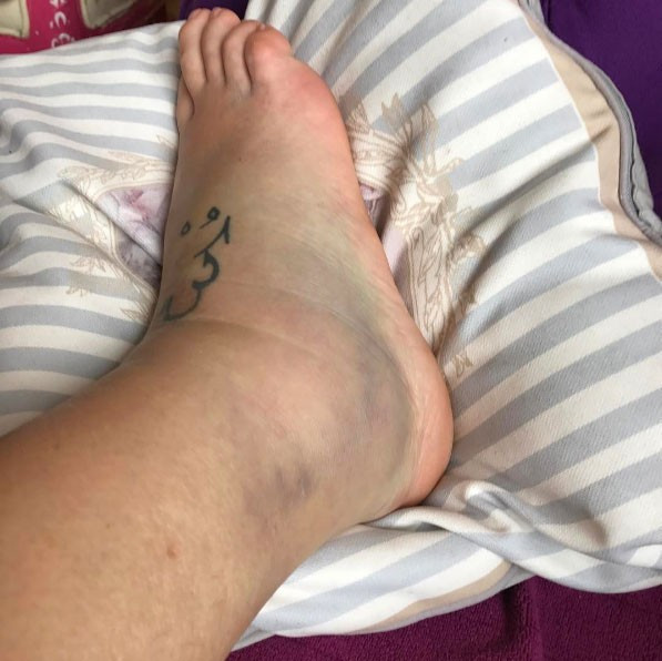 Seda Akgül'e ne oldu? Bu kez seksi pozları değil ama... - Resim: 4