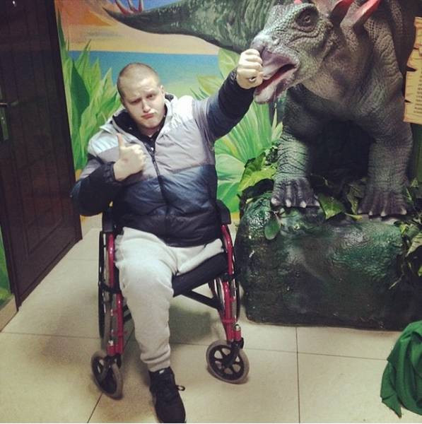 Bacağı kesildi hayatı değişti - Resim: 2