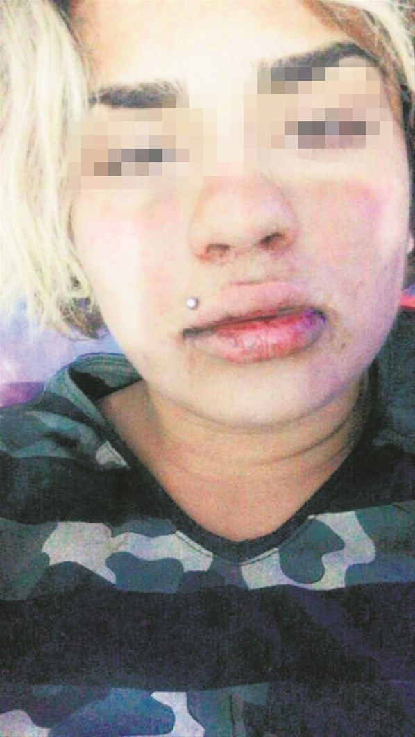 Lezbiyen çift hayatının şokunu yaşadı! - Resim: 3