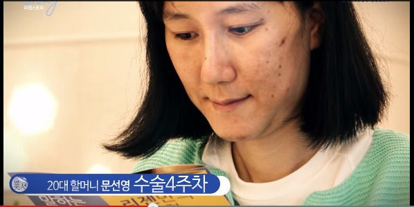 Koreli kadının estetik mucizesi - Resim: 4