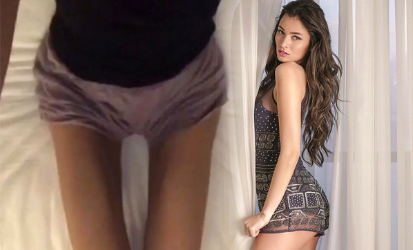 İrem Derici'nin hastalığı bu hale getirdi! Korkunç görüntü - Resim: 1