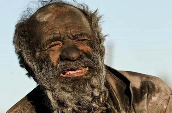 İnanılmaz olay: Dünyanın en kirli adamı temizlendi öldü! Hep korktuğu şey başına geldi - Resim: 2