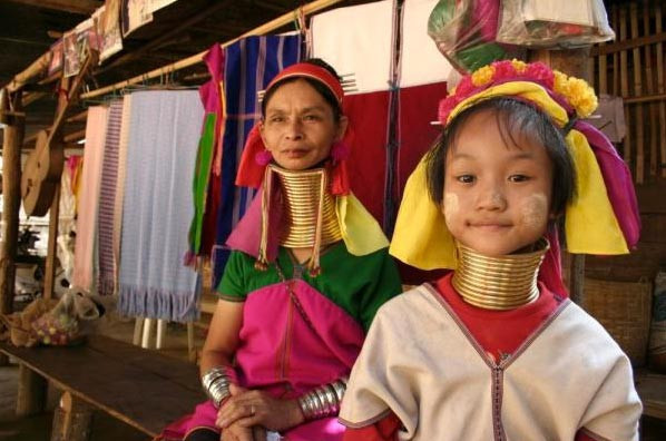 İşkence gibi güzellik anlayışı - Resim: 3