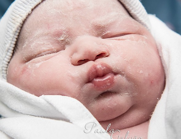 Birbirinden garip doğum anı fotoğraflarına çok şaşıracaksınız - Resim: 1