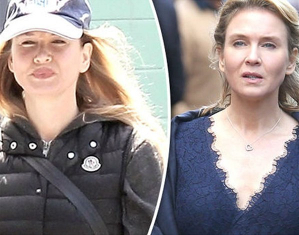 Dudaklara dolgu yaptıran ünlü oyuncunun hali fena - Resim: 4