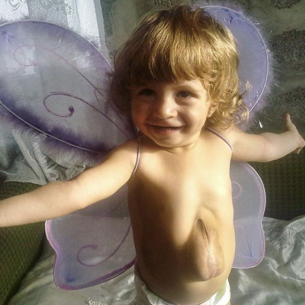 Böylesinin eşi benzeri yok 7 yaşındaki kız her güldüğünde... - Resim: 3