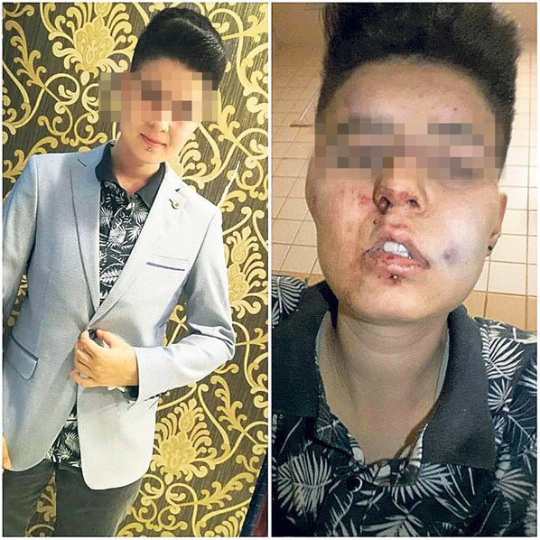 Lezbiyen çift hayatının şokunu yaşadı! - Resim: 2