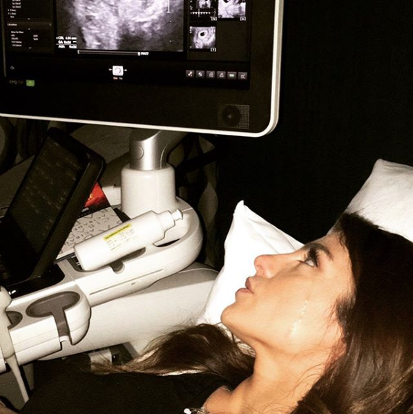 Hamile olan Bircan Bali eşi avukat Ömer Gezen ile boşandı iddialar doğru çıktı - Resim: 3