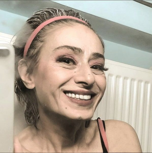 Yıldız Tilbe saçını kazıttı görenler büyük şaşkınlığa uğradı 'Asker hazır' - Resim: 1