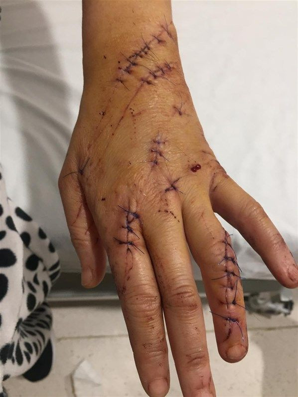 Adana'da platonik aşkı tarafından bıçaklandı kimse iş vermiyor - Resim: 4