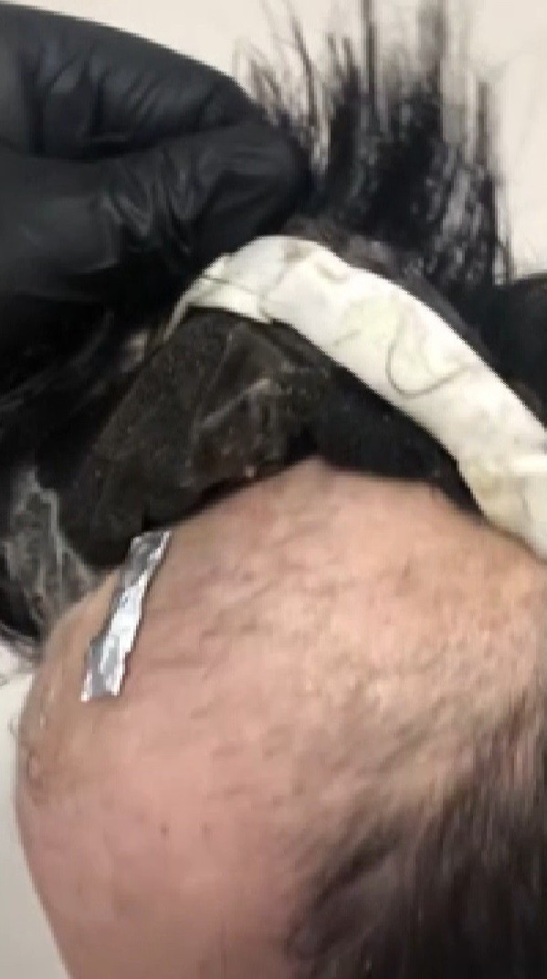 Gaziantep'te uyuşturucuyu peruğunun altına gizleyen zehir taciri pes dedirtti - Resim: 0