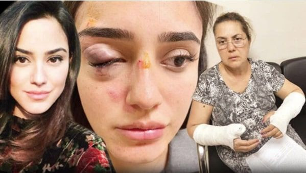 Ceren Kaplakarslan'ı ve annesini dövmüştü şoke eden gelişme ikinci kez hamile - Resim: 4