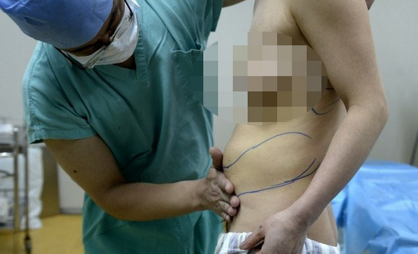 Silikon yaptırdığına yaptıracağına bin pişman oldu - Resim: 3