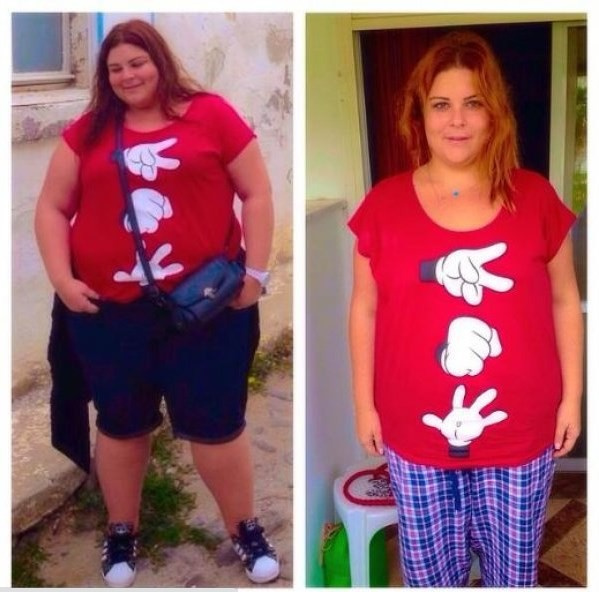 68 kilo verdi mayo bile giydi - Resim: 3
