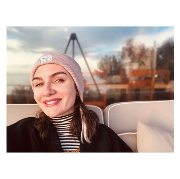 36 yaşındaki Birce Akalay 20'lik halini paylaştı estetik açıklaması bomba! - Resim: 2