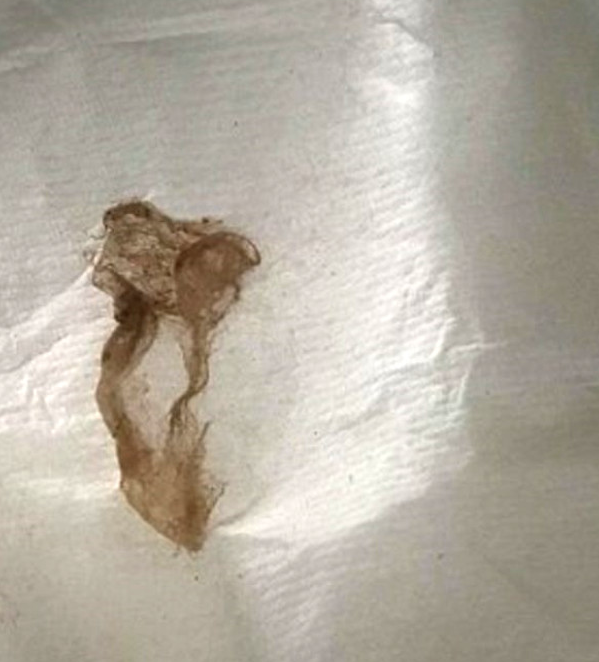 Cinsel organına koydu ölümden döndü aman dikkat! - Resim: 2