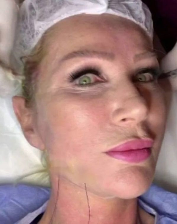 Seda Sayan'ın estetikli hali sanıldı Seren Serengil ortalığı karıştırdı - Resim: 2