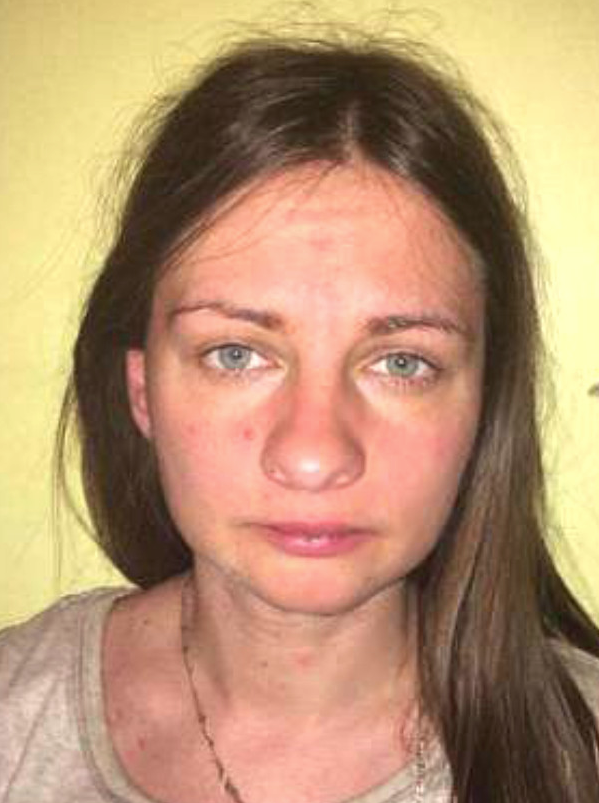 Depresyondan kurtulmak için gitti tecavüz edilip kafası kesilmiş halde bulundu! - Resim: 1