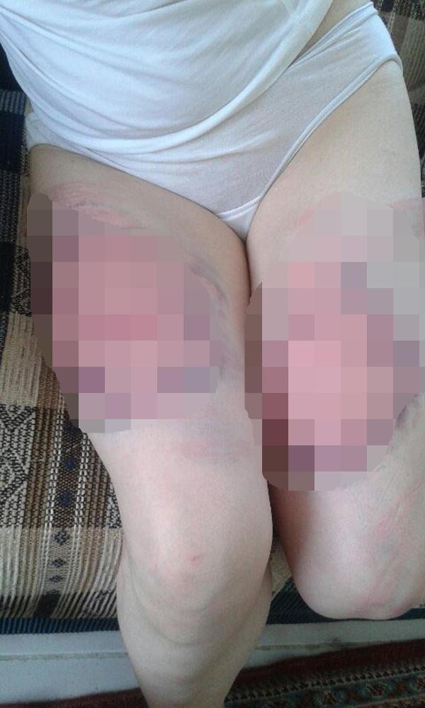 14 yıllık eşini önce soydu sonra oklavayla işkence etti - Resim: 2