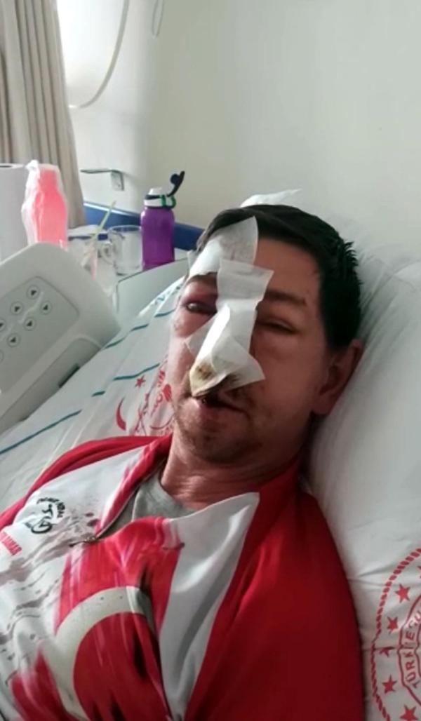 Tekirdağ'da yaşandı! Mazgala takılan bisikletten düştü burnu kırıldı, kafatası çatladı - Resim: 0