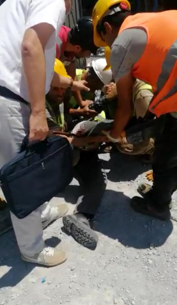 Antalya'da kalıp ustasının vücuduna giren demir kasığından çıktı - Resim: 0