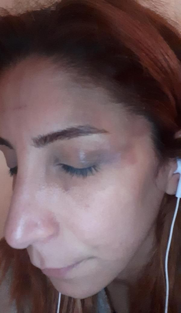 Veteriner kadına sevgili şiddeti! İşkence, sadistlik boyutundaydı ikinci şansı olmasın - Resim: 2