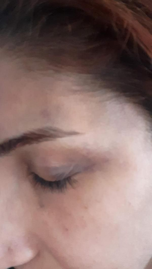 Veteriner kadına sevgili şiddeti! İşkence, sadistlik boyutundaydı ikinci şansı olmasın - Resim: 4