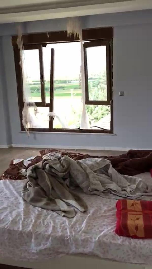 Saç kurutma makinesini çalıştırdı, patlamada bu hale geldi - Resim: 4