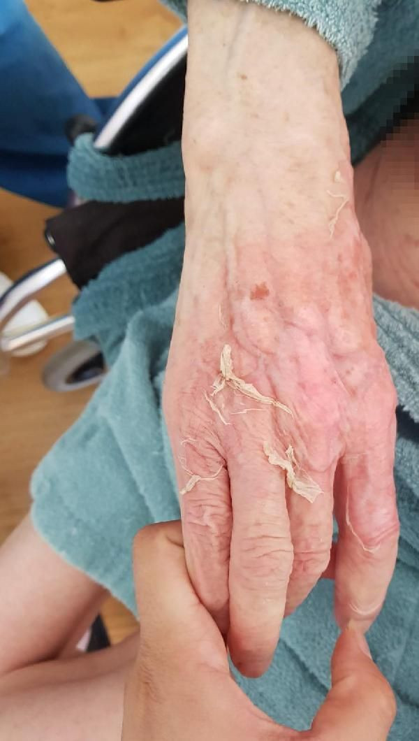 İzmir'de vahşet! Yaşlı bakım evinde banyo yaptırdıkları kadını kaynar suyla yakarak öldürdüler! - Resim: 2