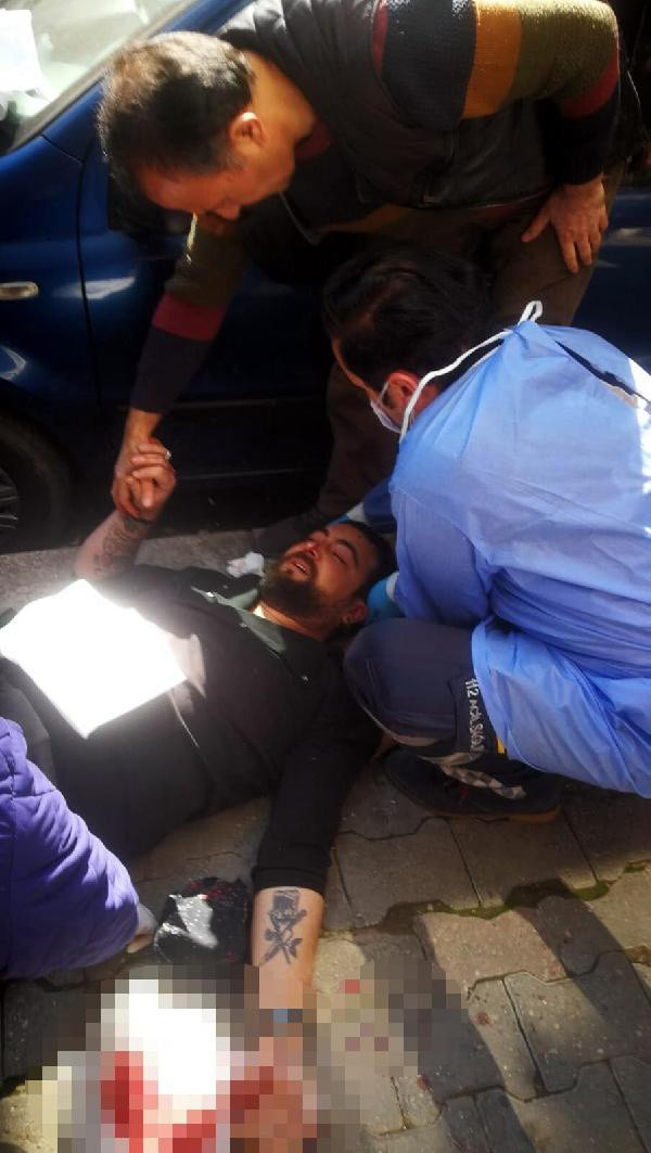 İzmir'de kapı yüzünden bu hale geldi bir anda oldu! 55 dikiş atıldı - Resim: 1