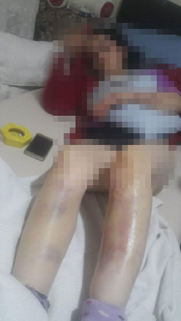 Bir kadın feryat ediyor! Boynumu kırdı dişlerimi döktü kurtarın beni... - Resim: 4