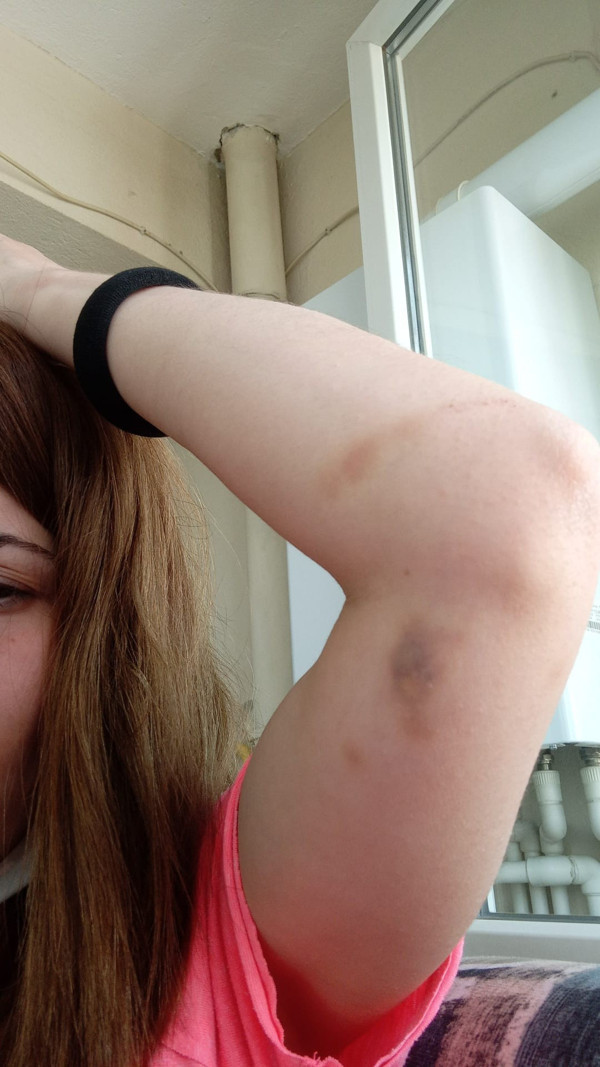 İzmir'de patronu genç kadına dehşeti yaşattı çığlık attı! Kırık cam üzerinde... - Resim: 0