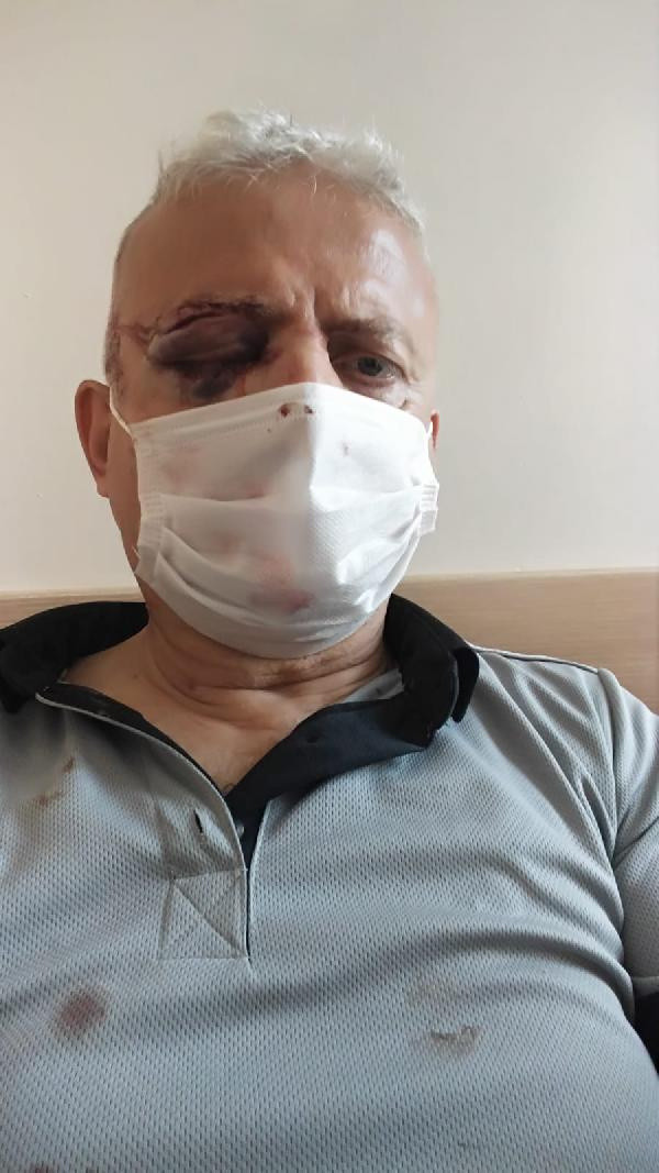 Metrobüste kör eden maske uyarısı! "Göğsünü gere gere gezmesi beni mahvetti" - Resim: 1