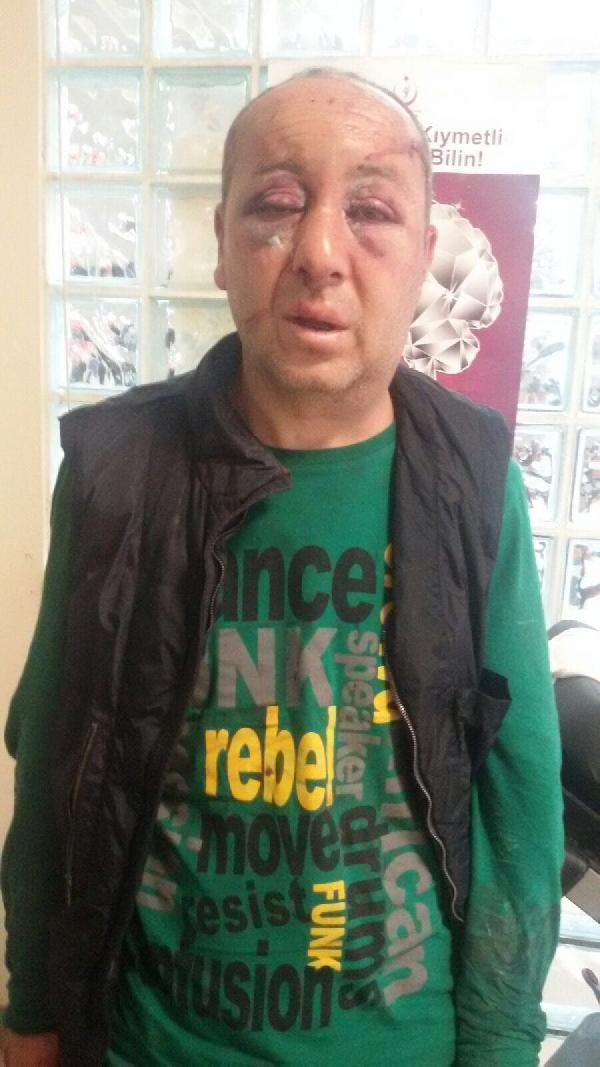 Cep telefoncuyu öldüresiye dövüp gasp ettiler! - Resim: 2