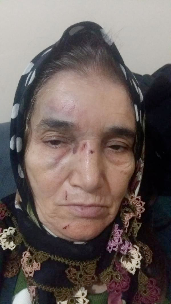 Fatma nine noterde feci şekilde dövüldü - Resim: 1