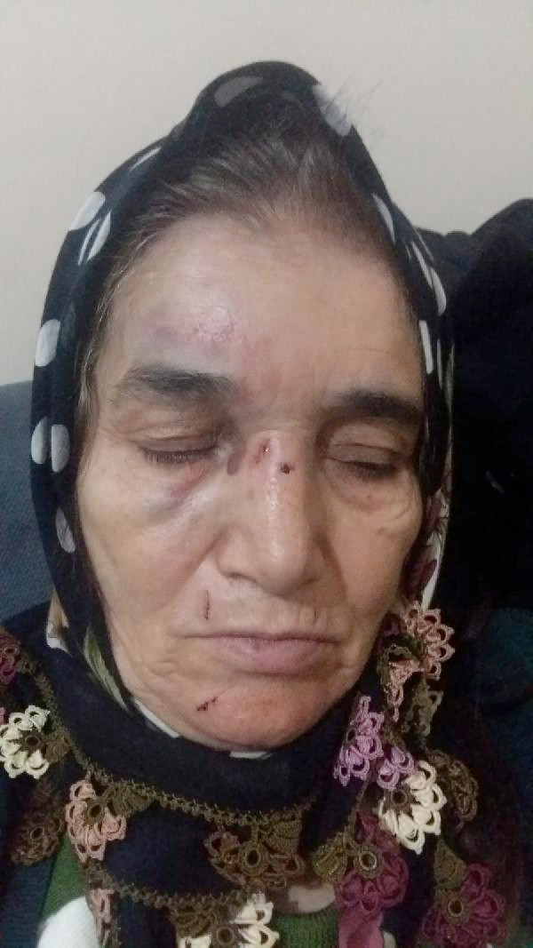 Fatma nine noterde feci şekilde dövüldü - Resim: 2