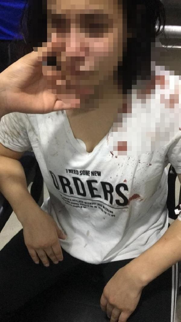 Rize'de eski sevgilisinin saldırısına uğrayan Rabia o anları ilk kez anlattı - Resim: 4