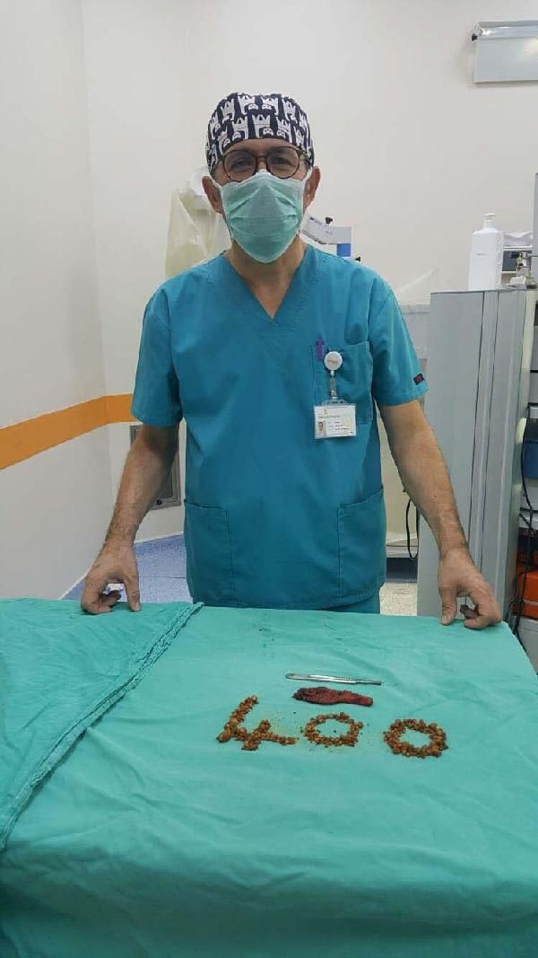 Manisa'da karın ağrısı şikayetiyle gitti! Safra kesesinden 400 taş çıkarıldı - Resim: 4