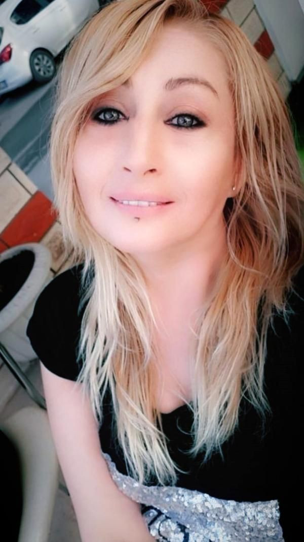 Güzellik uğruna 4 operasyon geçirdi hayatı kabusa döndü - Resim: 3