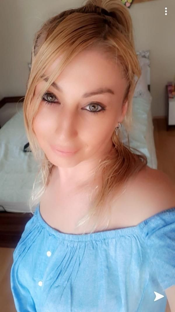 Güzellik uğruna 4 operasyon geçirdi hayatı kabusa döndü - Resim: 4