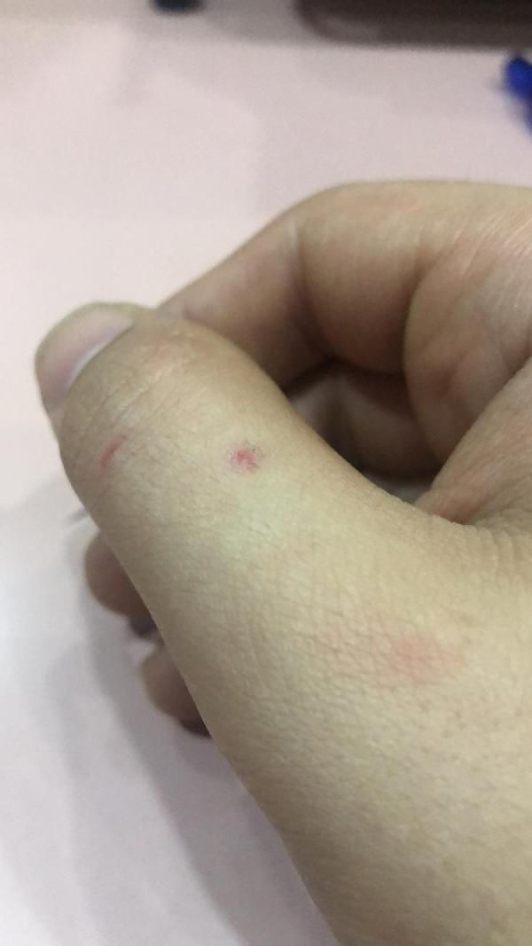 "Vampir sivrisinek" Asya Kaplan sivirisineğine biyolojik yöntemlerle çözüm aranacak - Resim: 4