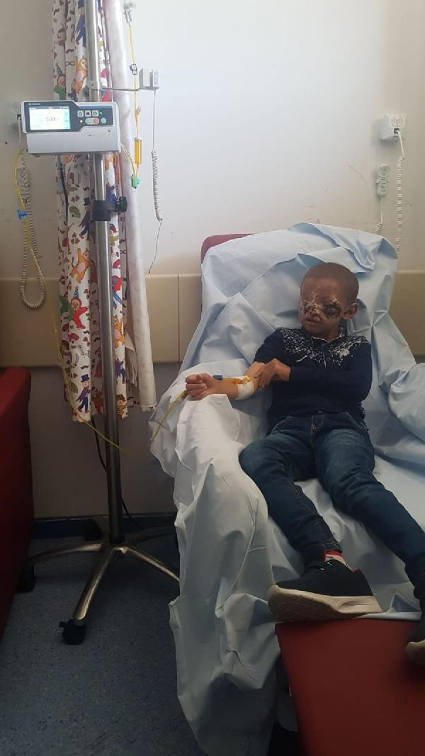 Erzurumlu 8 yaşındaki Salih güneşe çıkabilecek! Cilt kanseri yüzünü bu hale getirmişti - Resim: 4