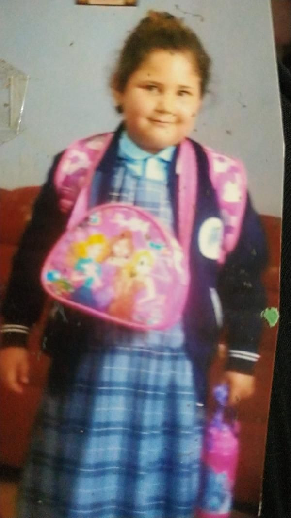 Fazla kiloları yüzünden okulu bırakmıştı! 60 kilo birden verdi son hali şaşırttı - Resim: 1