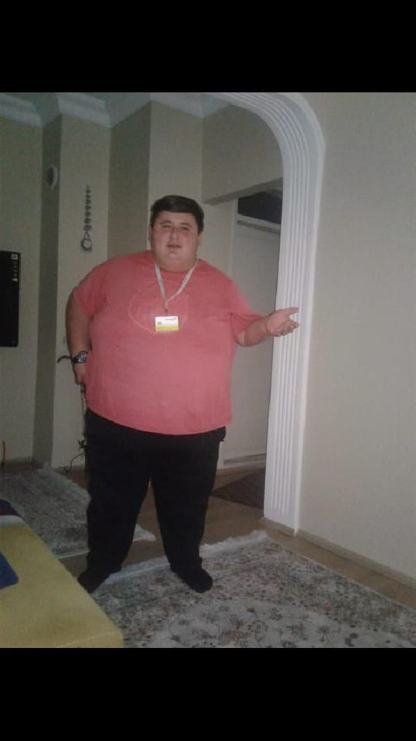Sevgilisi beğenmeyince 212 kilo verdi, yağlardan kurtulmak istiyor - Resim: 3