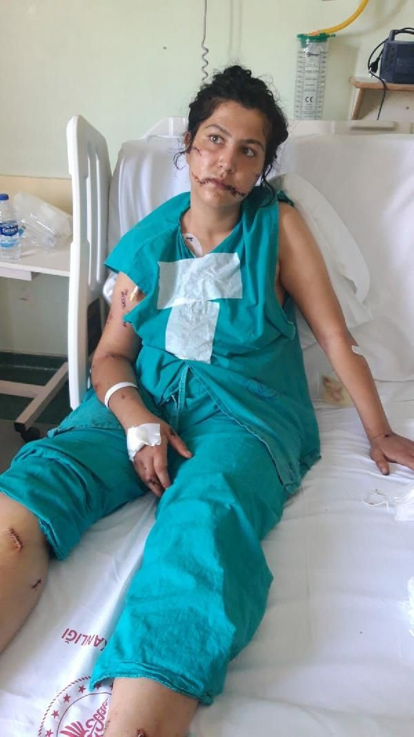 Abdest alıp 104 yerinden bıçakladı! Çocuğunun annesi can çekişirken başında sigara içti - Resim: 2