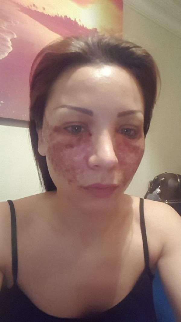 Bulgar modelin estetik kabusu! Kuaför kardeşler: Örümcek ağı yapmadık, iftira - Resim: 2