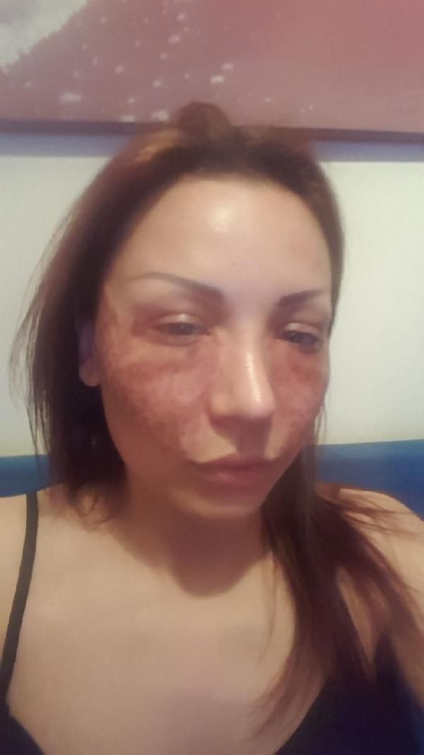 Bulgar modelin estetik kabusu! Kuaför kardeşler: Örümcek ağı yapmadık, iftira - Resim: 4