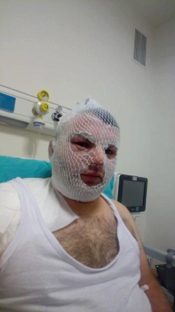 Düdüklü tencere suratında patladı! Markayı şikayet edecek - Resim: 2