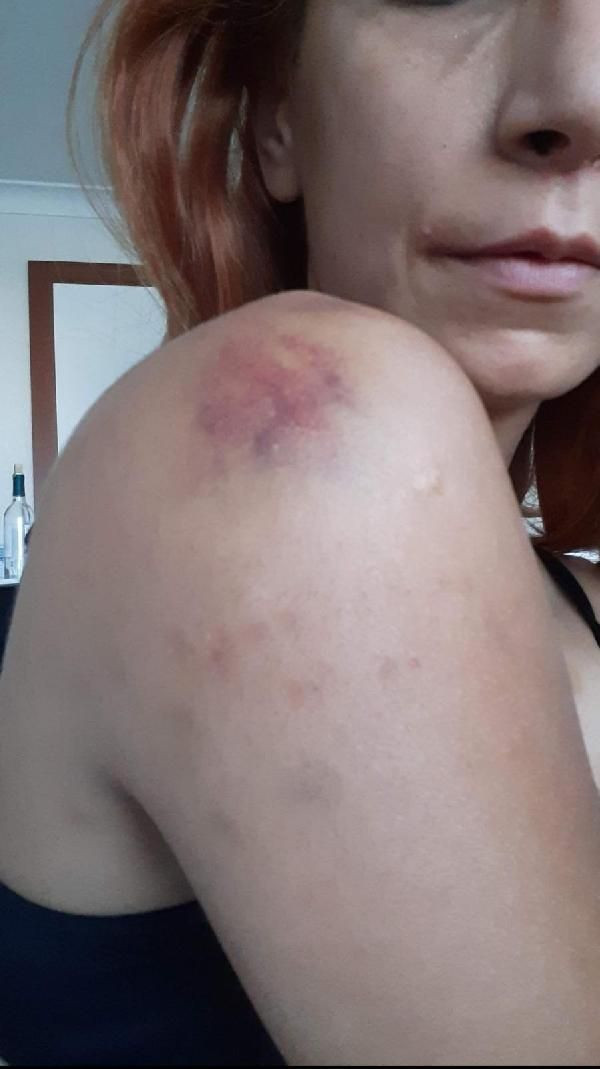 Veteriner kadına sevgili şiddeti! İşkence, sadistlik boyutundaydı ikinci şansı olmasın - Resim: 3